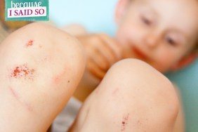 Parenting Blog - Skinned Knees