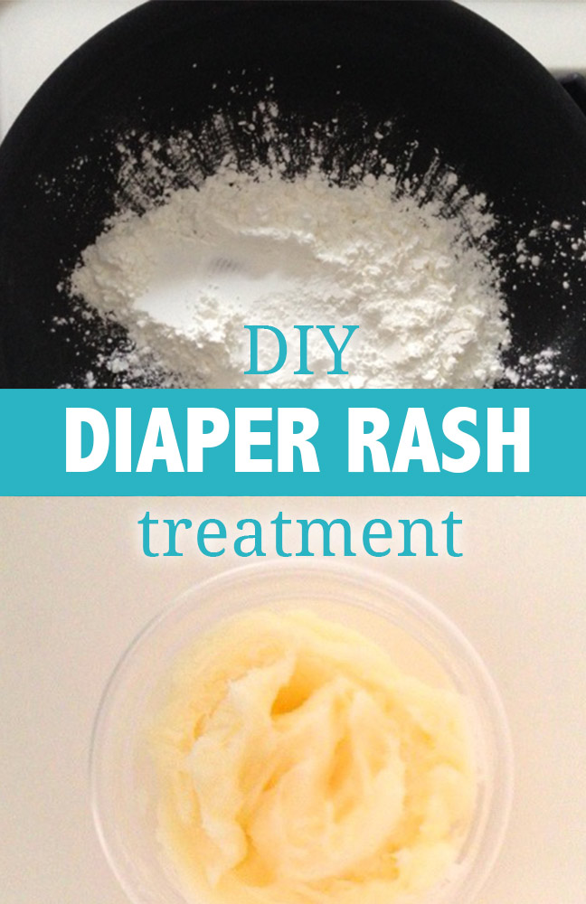 diy-diaper-rash-treatment