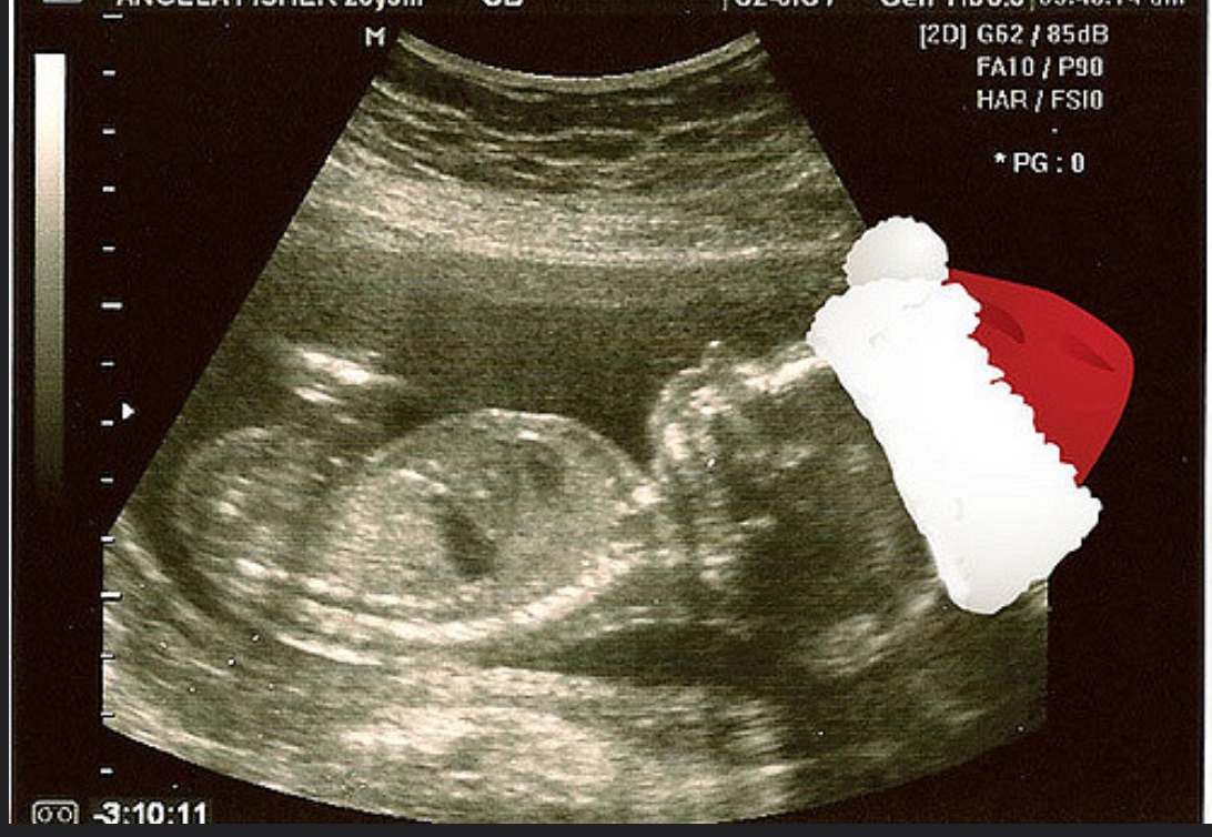 Holiday Themed Pregnancy Announcement Ideas Gallery