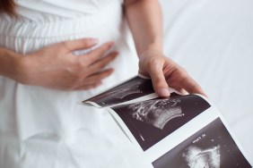 conceiving after miscarriage
